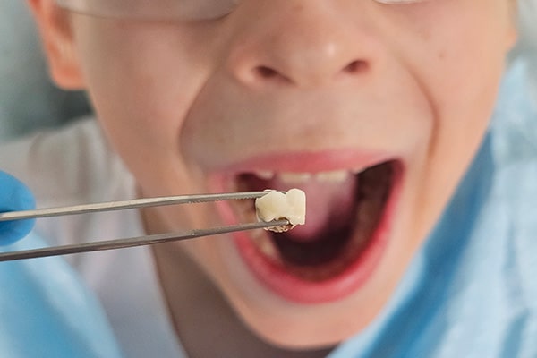 Dental Crowns