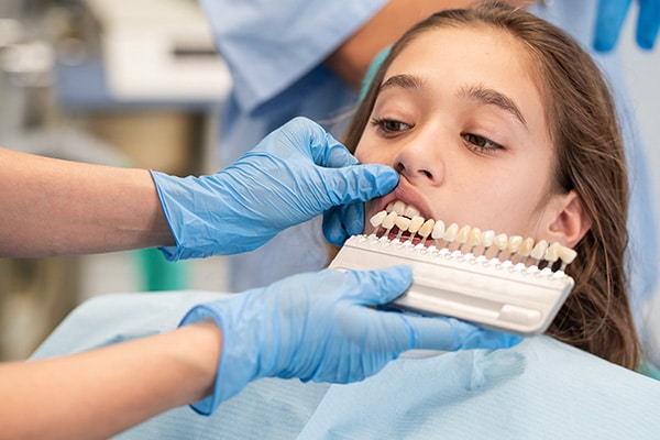 Composite Fillings and Bonding