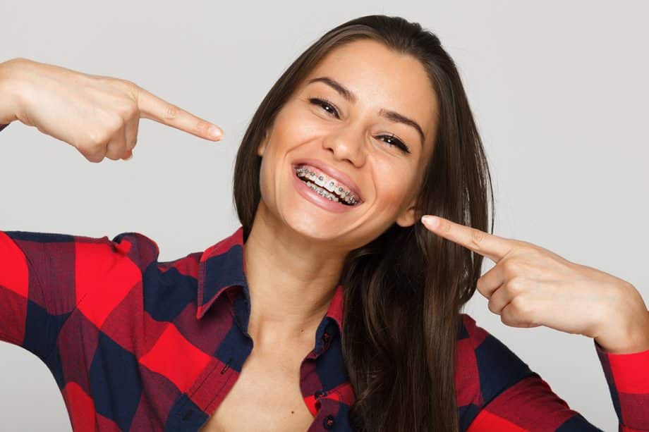 Top 10 Braces Questions & Answers
