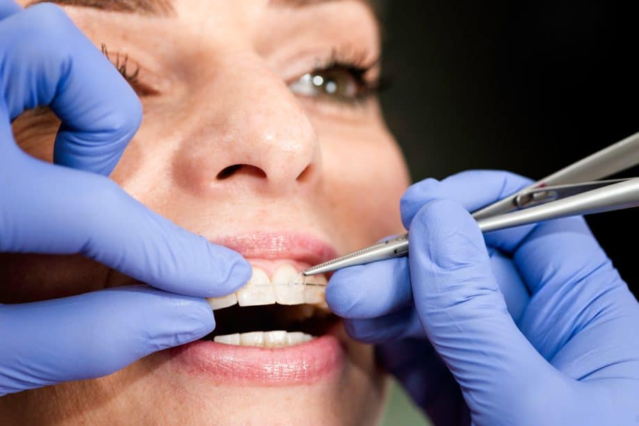 What to Expect from Surgical Orthodontic Treatment in Jacksonville Beach