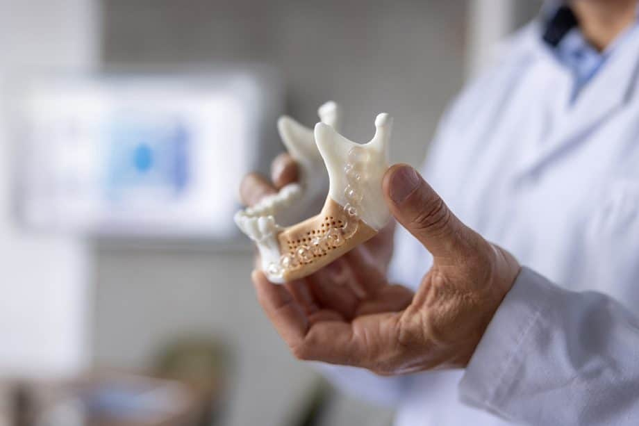 When is Surgical Orthodontics Necessary for Jaw Alignment?